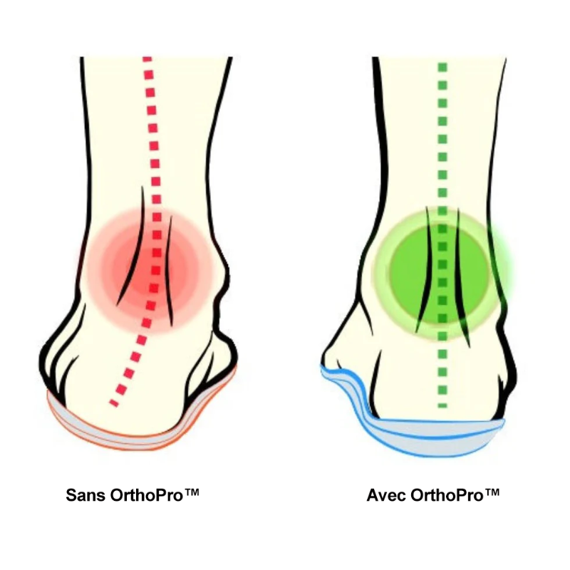 Semelles Orthopédiques – Soulagement immédiat des douleurs au pied et correction de la posture