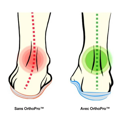 Semelles Orthopédiques – Soulagement immédiat des douleurs au pied et correction de la posture