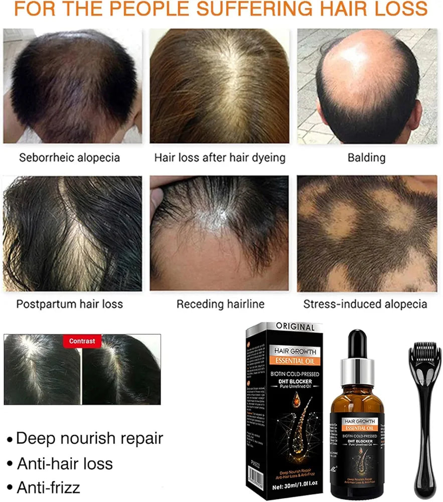 Pack Croissance Capillaire – Huile Essentielle + Dermaroller