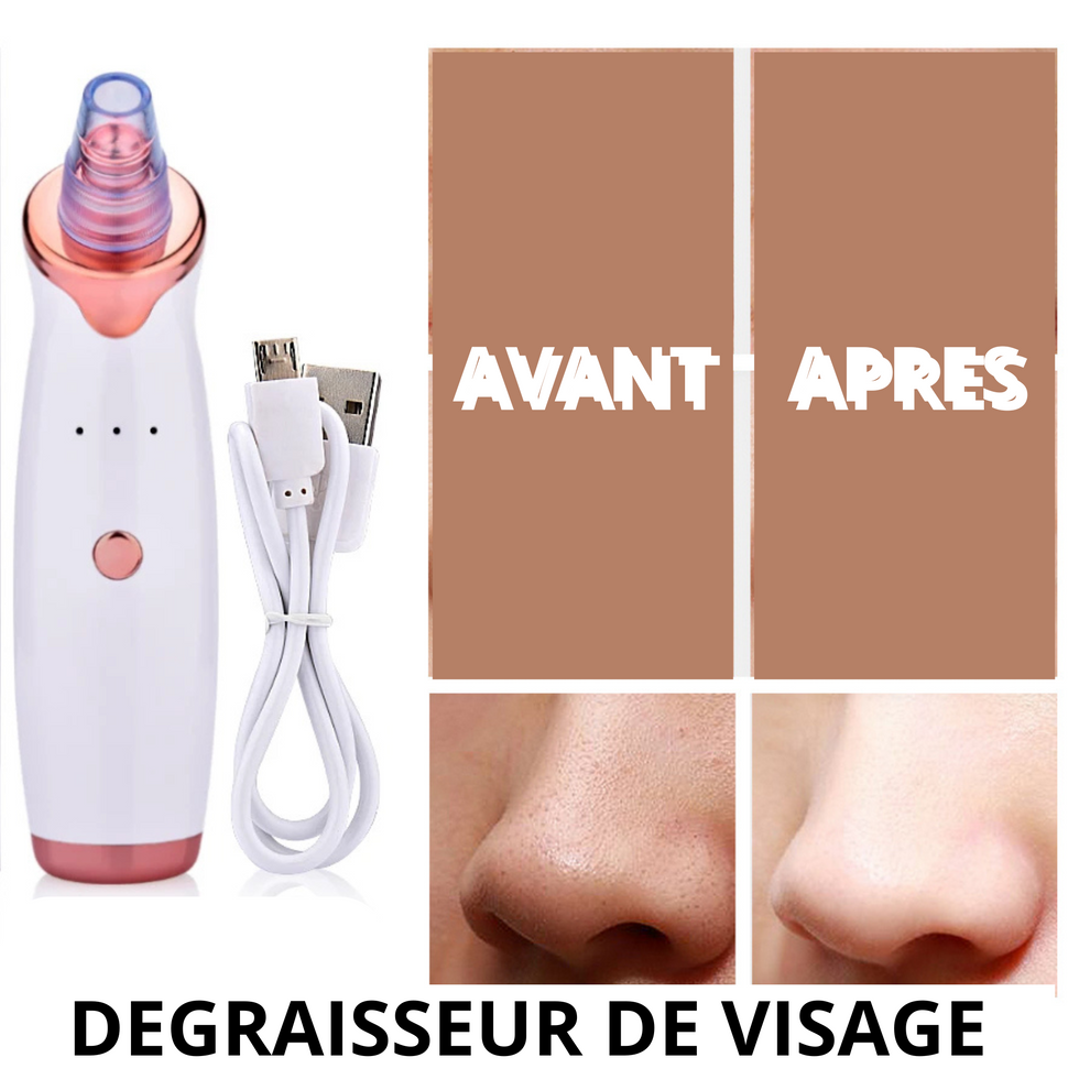 Extracteur de Points Noirs et de Graisse - Pour une Peau Nette et Rayonnante