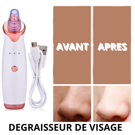 Extracteur de Points Noirs et de Graisse - Pour une Peau Nette et Rayonnante