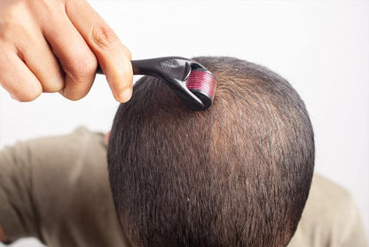 Boostez la Repousse de Vos Cheveux avec le Dermaroller Professionnel