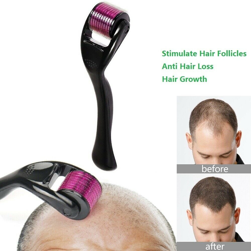 Boostez la Repousse de Vos Cheveux avec le Dermaroller Professionnel